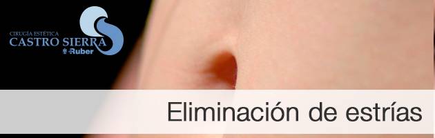 Eliminación de estrías Madrid
