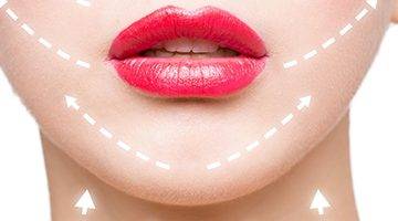 cicatrices del lifting facial