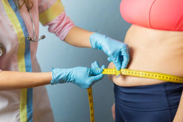 Therapist taking obese woman's body waist measurements