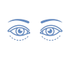 Blefaroplastia