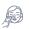 Laser Facial