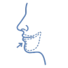 Mentoplastia